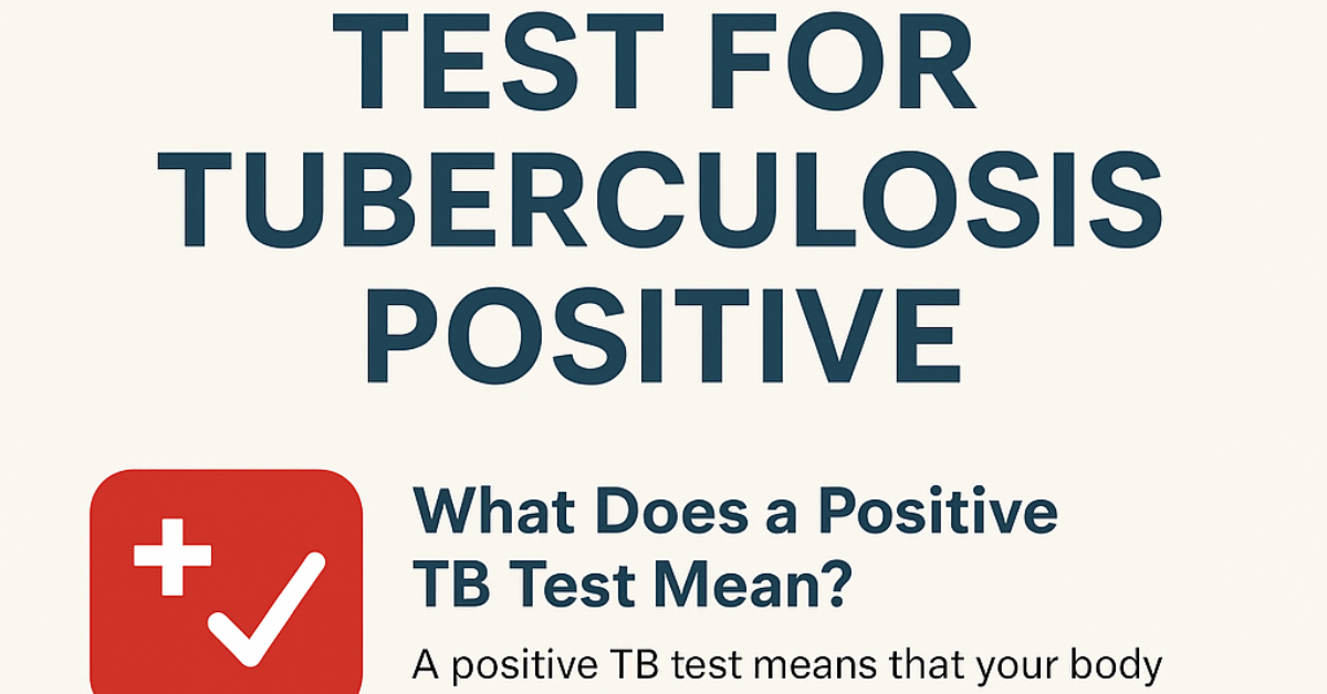 Test for Tuberculosis Positive Meaning, Types, Diagnosis